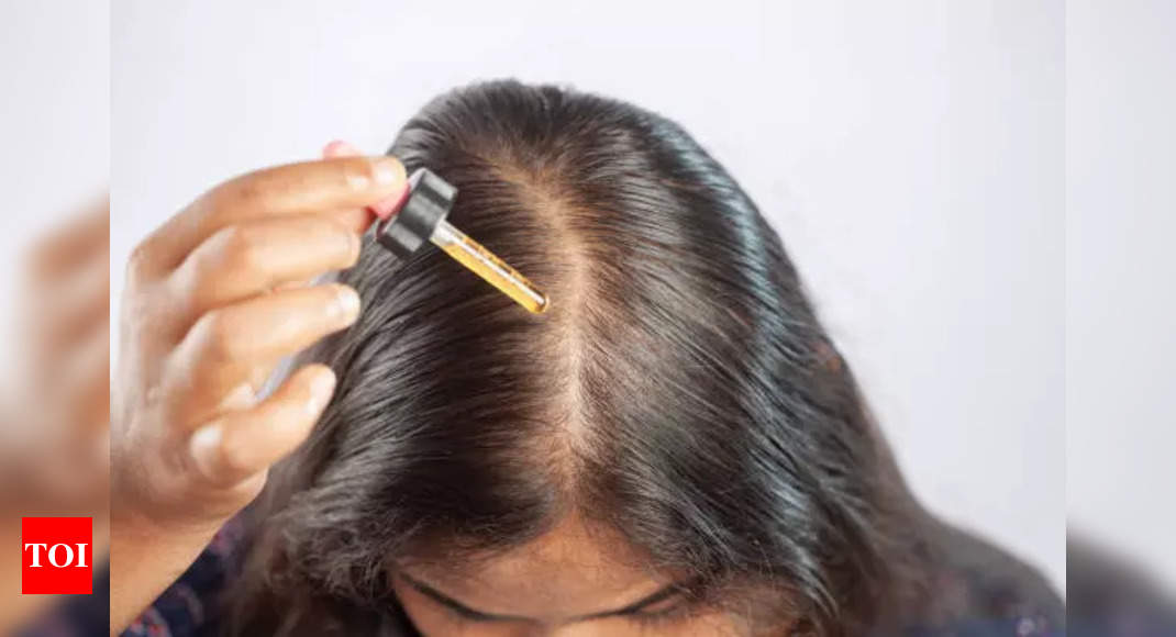 हेयर फॉल: यह तेल के बालों का सबसे अच्छा तरीका है यदि आप गंभीर बालों के झड़ने से पीड़ित हैं |